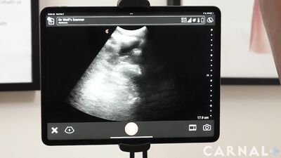 Noah vol 1 - Anal Ultrasound - gay porn